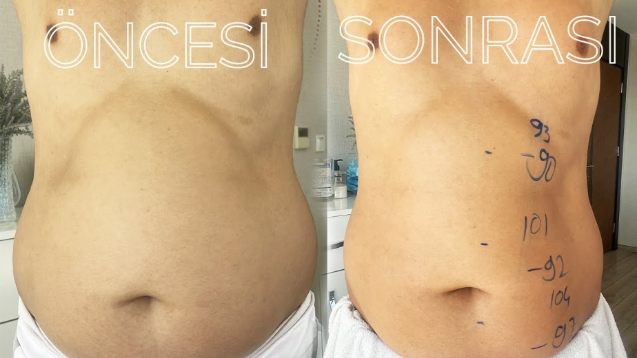 image_2024-08-09_090837916